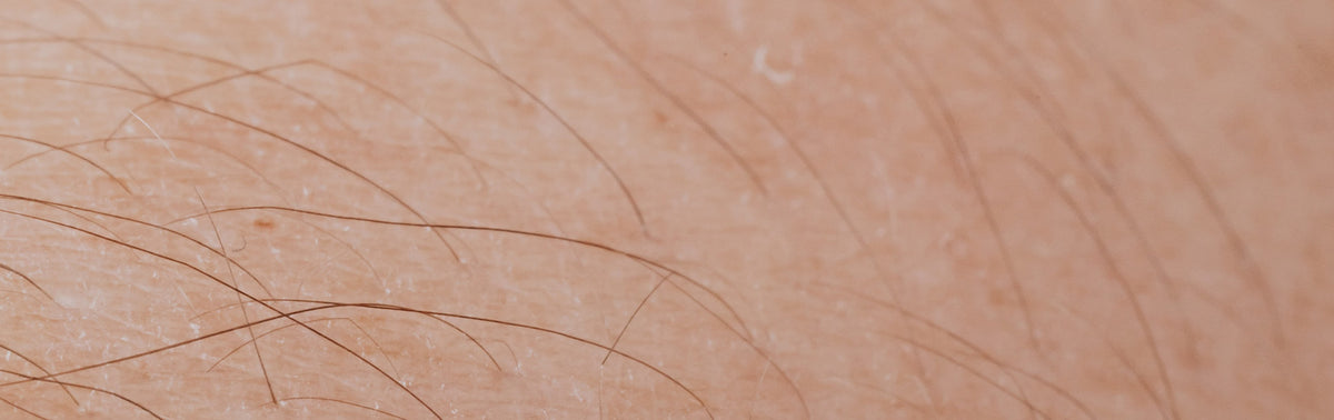 Is IPL hair removal safe?