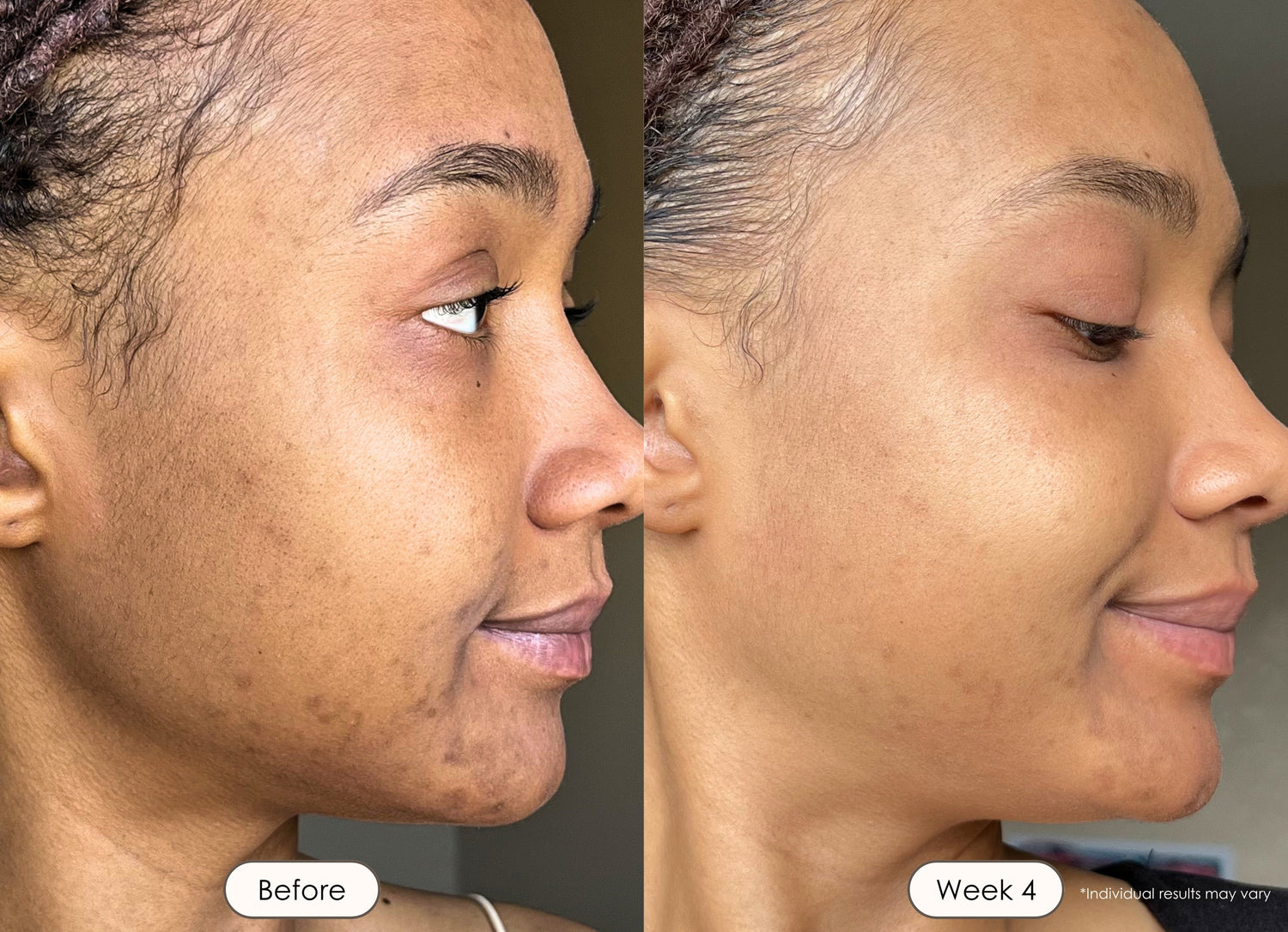 Before and after skincare comparison with visibly refreshed and glowing skin. 